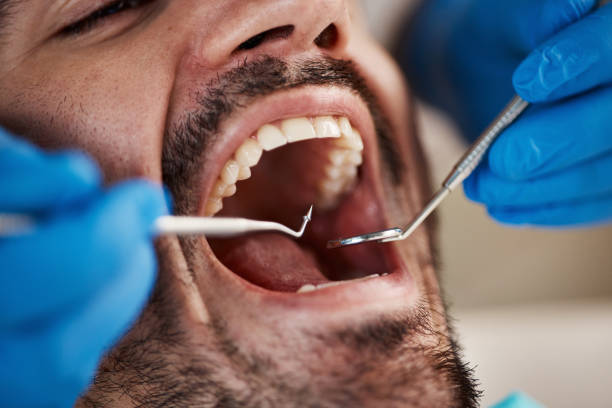 Best Emergency Orthodontic Repairs in Bostonia, CA